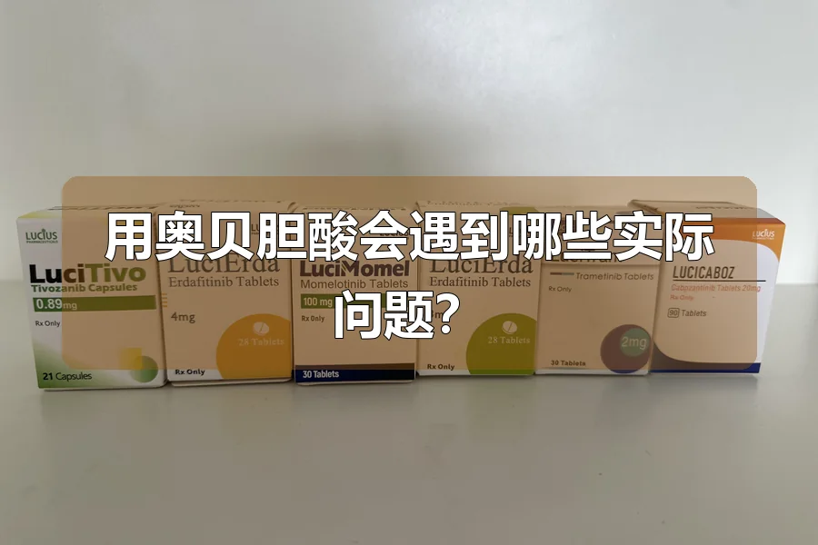 用奥贝胆酸会遇到哪些实际问题?